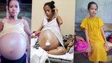 Žena (28) si myslela, že je těhotná: V těle má šest nádorů vážících 90kg!