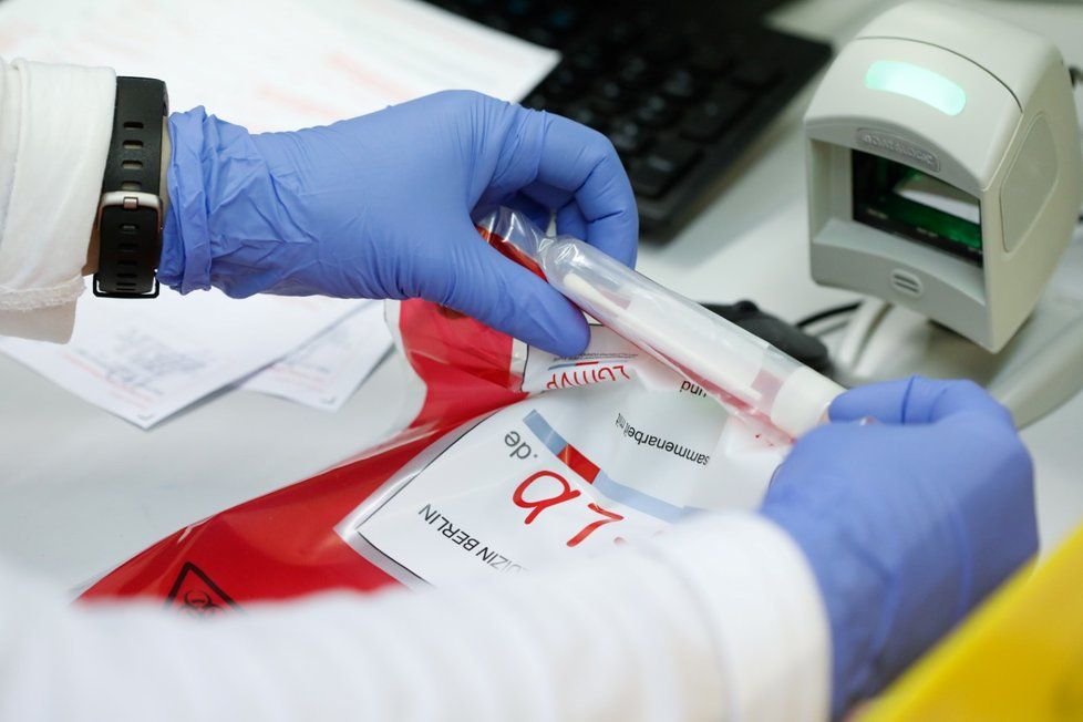 Testy na koronavirus v laboratoři v Berlíně