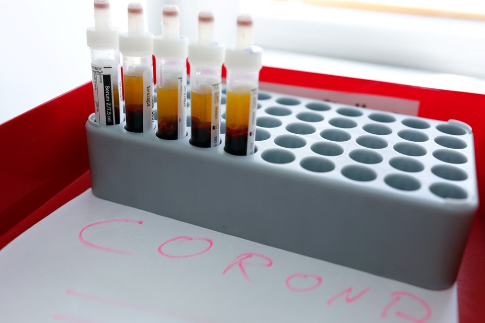 Testy na koronavirus v laboratoři v Berlíně