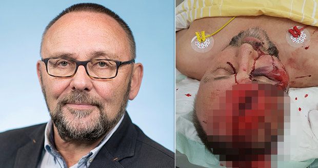 Poslanec po útoku ležel v kaluži krve. Maskovaní muži s tyčemi napadli člena AfD