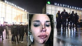Když dorazí policie na místo pozdě… Jedna z žen, které útočníci rozbili obličej lahví. Poté ji okradli.