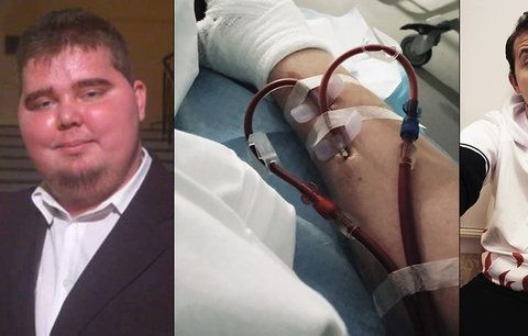 Frantu (22) málem zabily nemocné ledviny. Trhala se mu kůže, smrti se „vysmál“
