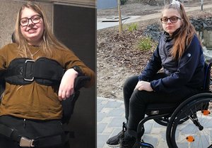 S Kateřinou (19) z Nových Jiren se život nemazlí. Nejdřív skončila na vozíku, pak na kyslíku...
