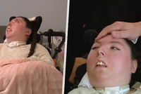 Alex se narodila bez mozku: Překonala očekávání lékařů, oslavila 20. narozeniny