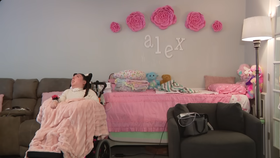 Alexa Simsponová se vzácným onemocněním hydranencefalie