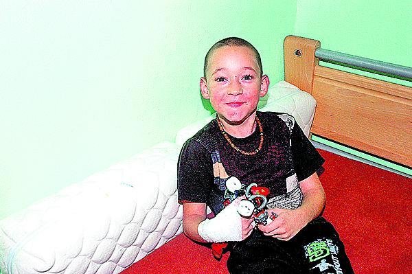 Malý Samuel (7) bojuje s nemocí motýlích křídel