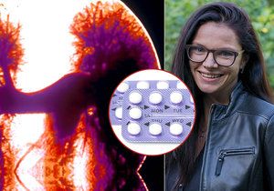 Zdravotní potíže Zuzany Dvořákové odstartovalo užívání hormonální antikoncepce.