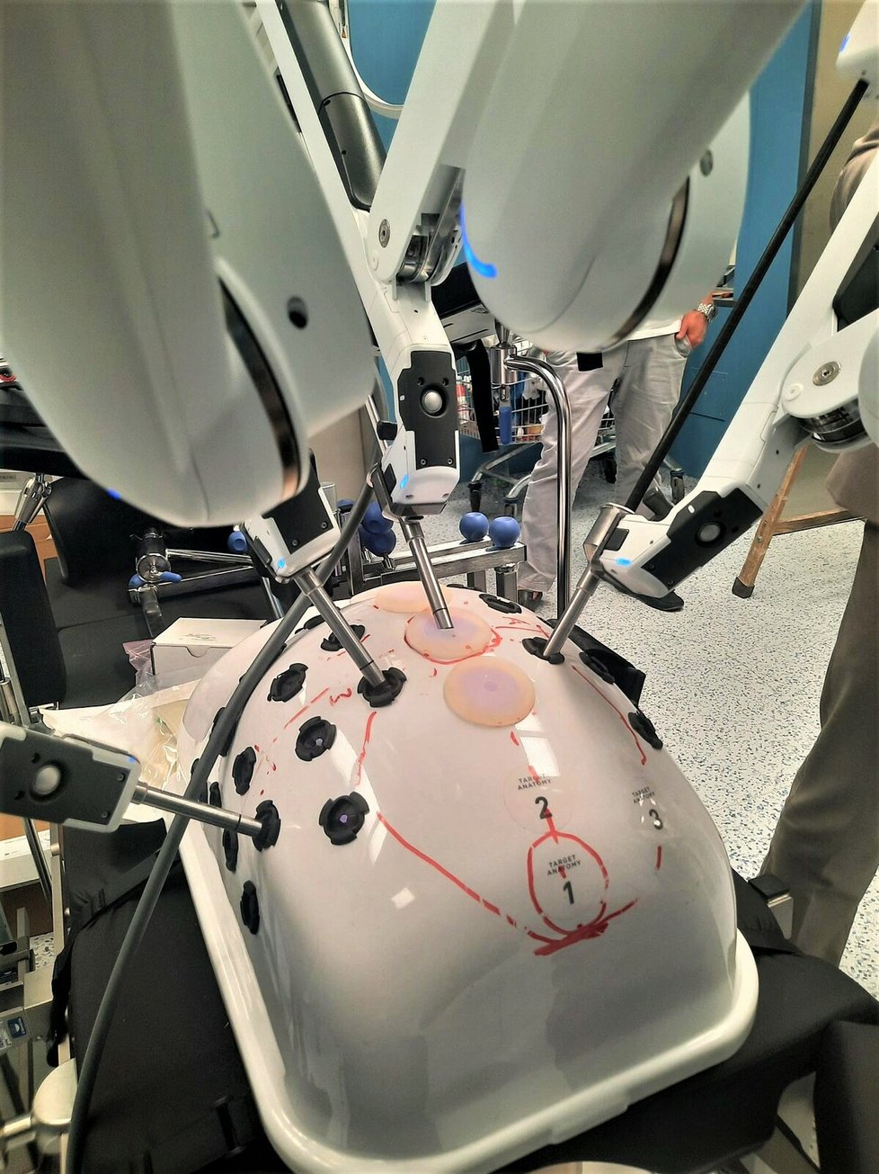 V pražské Fakultní Thomayerově nemocnici od září operují pacienty velmi moderním robotickým systémem za několik desítek milionů korun.