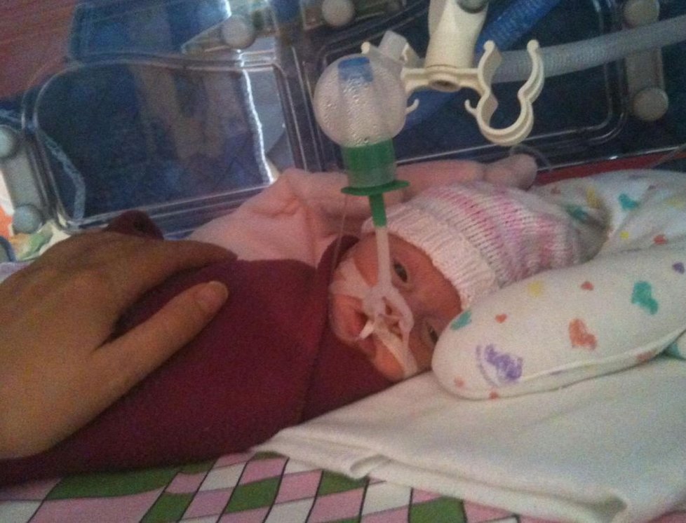 Emma a Matyáš se narodili o 3,5 měsíce dřív. První čtyři měsíce svého života děti strávily v inkubátoru.