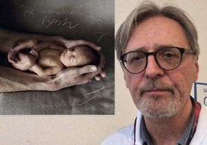 Profesor Richard Plavka se věnuje novorozencům ve VFN od roku 1986, vyprávěl neuvěřitelný příběh irské rodiny.