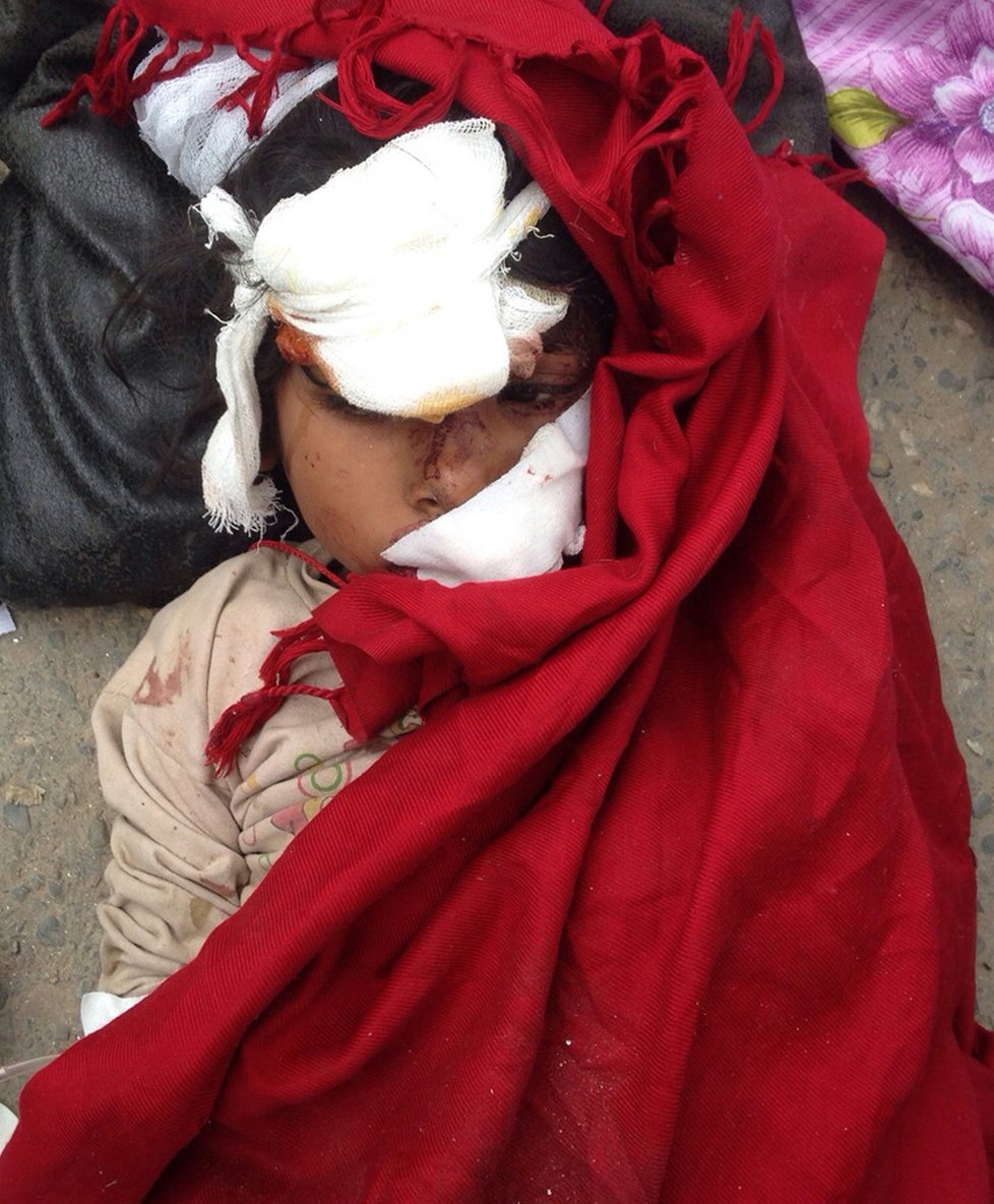 Vystrašené dítě poblíž nemocnice v Káthmándú v Nepálu.