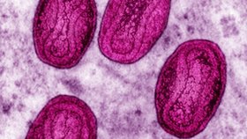 Virus neštovic