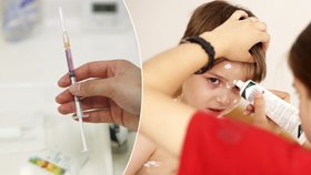 V Česku chybí vakcíny proti planým neštovicím: Proti opičím stejně nechrání, varují pediatři (ilustrační foto)