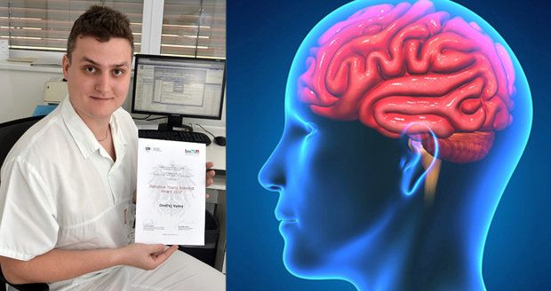 Neurolog Ondřej Volný z Fakultní nemocnice u svaté Anny v Brně přišel na novou metodu zobrazení mozku, která pomůže rychleji odhalit mrtvici. 