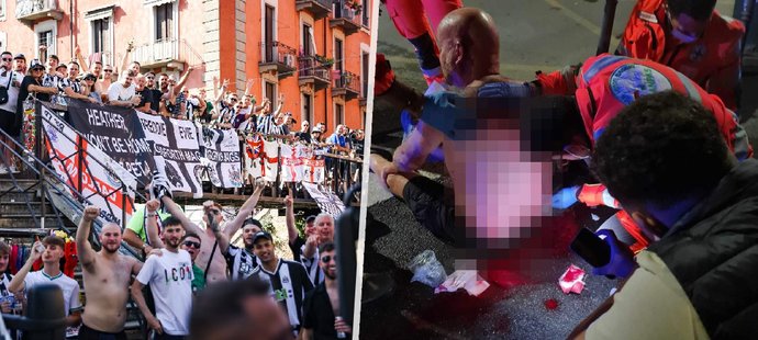 Fanoušek Newcastlu Eddie McKay byl v Miláně napaden skupinou útočníků s mačetami