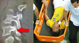 Brazílie pláče! Neymar má zlomený obratel, na MS si už nezahraje