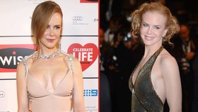 Nicole Kidman má podezřele velká ňadra.