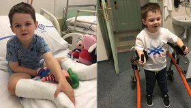 Malému Nicolasovi lékaři diagnostikovali hned několik vážných postižení, které mu hodně komplikují život. Trpí mozkovou obrnou a vodnatěním mozku, epilepsií a mentální retardací, navíc je ochrnutý na polovinu těla.