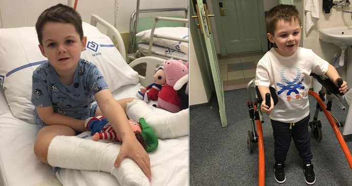 Malému Nicolasovi lékaři diagnostikovali hned několik vážných postižení, které mu hodně komplikují život. Trpí mozkovou obrnou a vodnatěním mozku, epilepsií a mentální retardací, navíc je ochrnutý na polovinu těla.