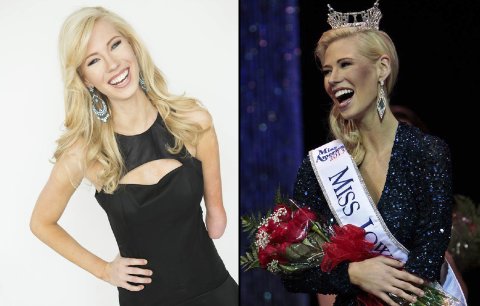 Překvapení v soutěži krásy: Americkou Miss se stala dívka bez ruky