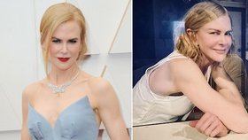 Nestárnoucí Nicole Kidmanová šokovala na sociální síti: Co to má s obličejem?!