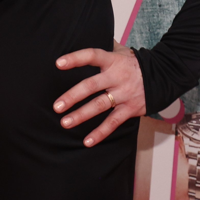 Lenka Krobotová se snubním prstenem.