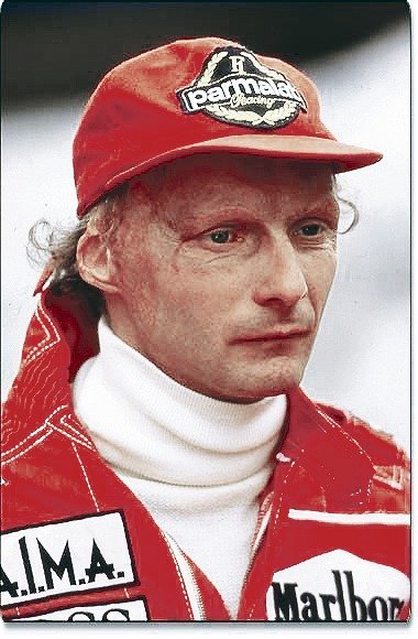 Při nehodě v roce 1976 Niki málem uhořel. Přišel o část ucha a utrpěl popáleniny v obličeji.