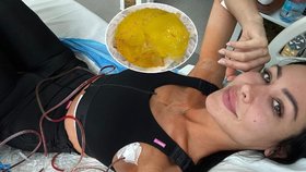 Modelka Nikol Dotková se svěřila s hrůznou zkušeností s plastickou operací prsou.