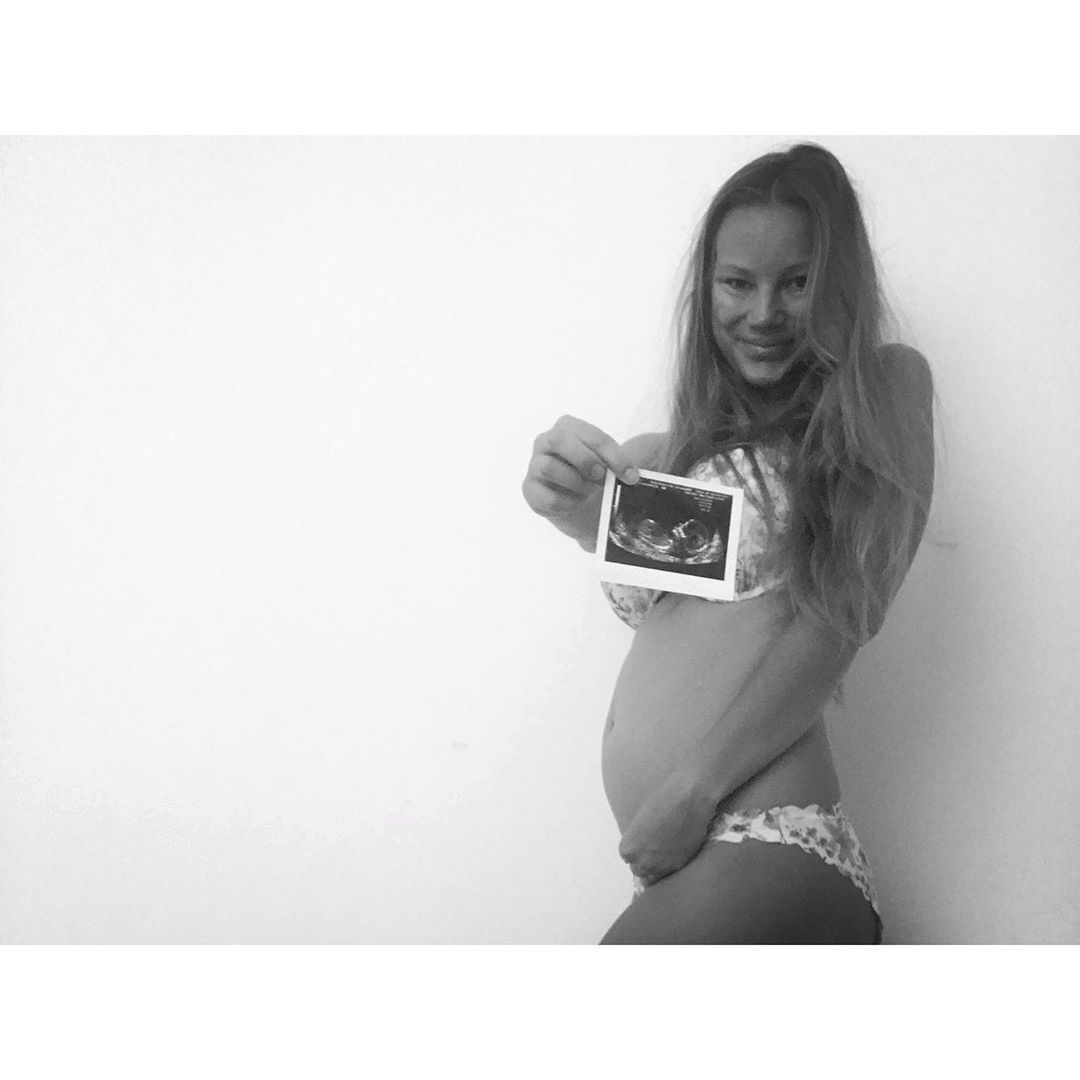 Nikola Hezucká se pochlubila svým rostoucím bříškem a ultrazvukem na instagrau