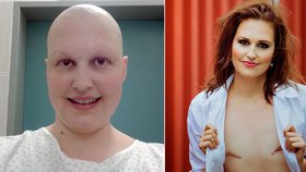 Vášnivá sportovkyně, abstinentka a nekuřačka. Přesto Nikola Samková zjistila, že rakovina žádná kritéria pro to, koho si vybere, nemá. Nahmatala si bulku v prsu!
