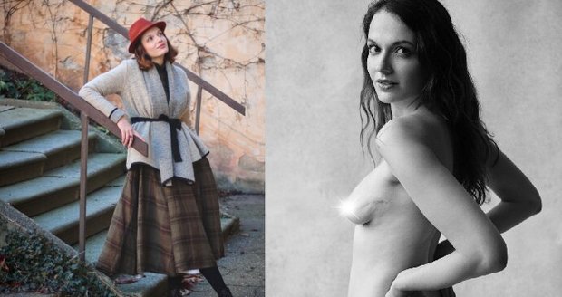 Nikola Zámečníková onemocněla rakovinou prsu v mladém věku. Dnes pomáhá s osvětou o této nemoci.