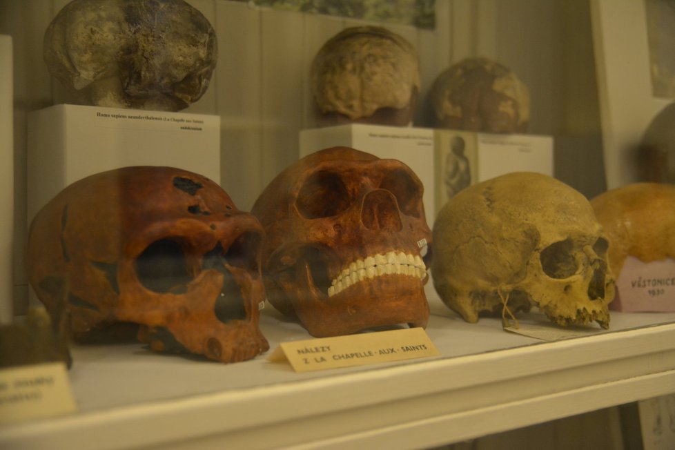 Anatomické muzeum lákalo celou Prahu. Avšak na prohlídku se dostala jen hrstka zájemců.