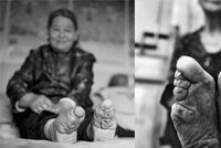 Poslední oběti zakázaného rituálu: Malé nohy Číňanek muže vzrušovaly a z žen dělaly dámy