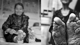 Poslední oběti zakázaného rituálu: Malé nohy Číňanek muže vzrušovaly a z žen dělaly dámy