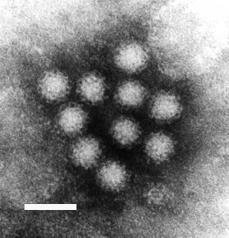 Norovirus.