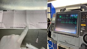 Muž z Nového Strašecí prodělal náhlou zástavu oběhu: Rychlá reakce manželky mu zachránila život!