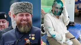 Útok na kritičku Putinova spojence Kadyrova: Novinářku brutálně zbili a oholili jí vlasy