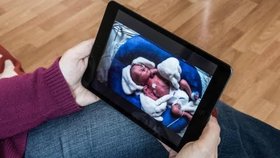 První novorozenecká „televize“ v Česku. Rodiče vidí inkubátor na tabletu