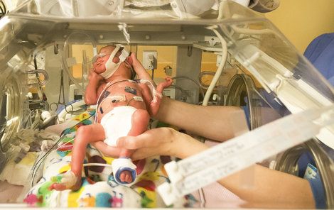 Předčasně narozeným dětem pomáhají inkubátory, díky nim překonají kritické momenty.