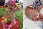 Novorozená holčička bojovala s meningitidou: Lékaři jí namočili hlavu do ledové vody, aby ji zachránili