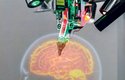 Implantát do mozku? Operace prý bude bezbolestná