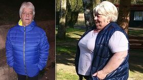 Marii z váhy 137 kilo pomohla až operace. Češi jsou už tlustší než Američané