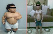 Chlapečkovi odřízli jako nejmladšímu kus žaludku! Ve dvou letech vážil 33 kg