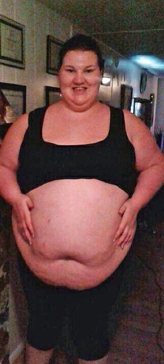 Obézní matka prodělala v šestém měsíci těhotenství mrtvici. Teprve to ji donutilo zhubnout.