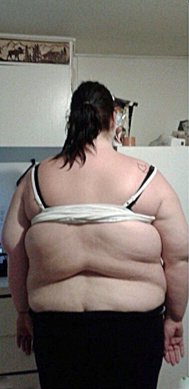 Obézní matka prodělala v šestém měsíci těhotenství mrtvici. Teprve to ji donutilo zhubnout.