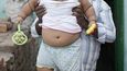 Jedním z nejzávažnějších problémů je prudký nárůst obézních dětí.