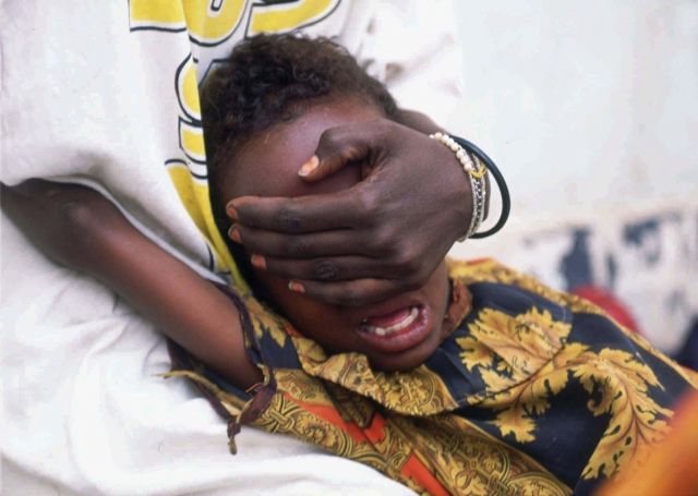 Ženská obřízka (ilustrační foto)