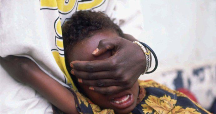 Ženská obřízka (Ilustrační foto)