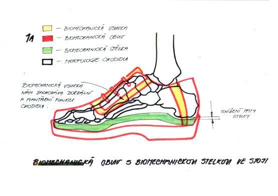 Srovnání polohy chodidla v běžné obuvi a obuvi navržené Josefem Hanákem. Jeho výrobek umožňuje, aby vznikla podélná a příční klenba, která umožní v botě přirozený pohyb, jako by šel člověk naboso.