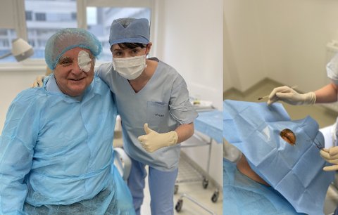 Nový lék proti degeneraci zraku pomohl Jaroslavovi (77): Injekcemi odvrací slepotu!